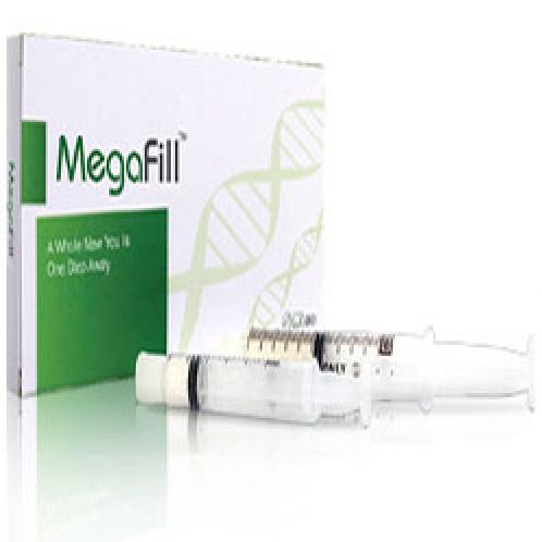 MegaFill | Filler, MegaFill