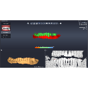 [3D Industrial] DentiqGuide